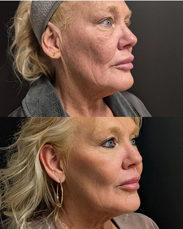 Before and after facial transformation comparison.