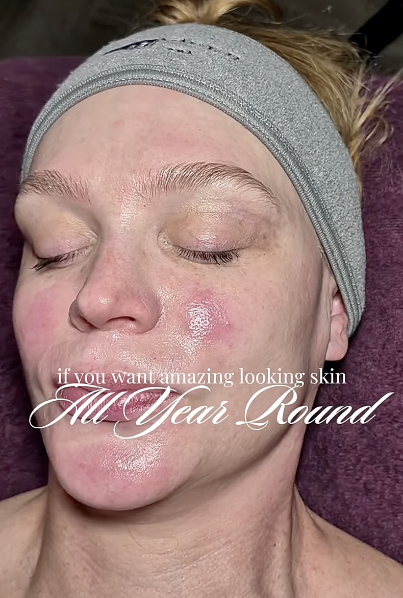 Facial treatment for year-round glowing skin.