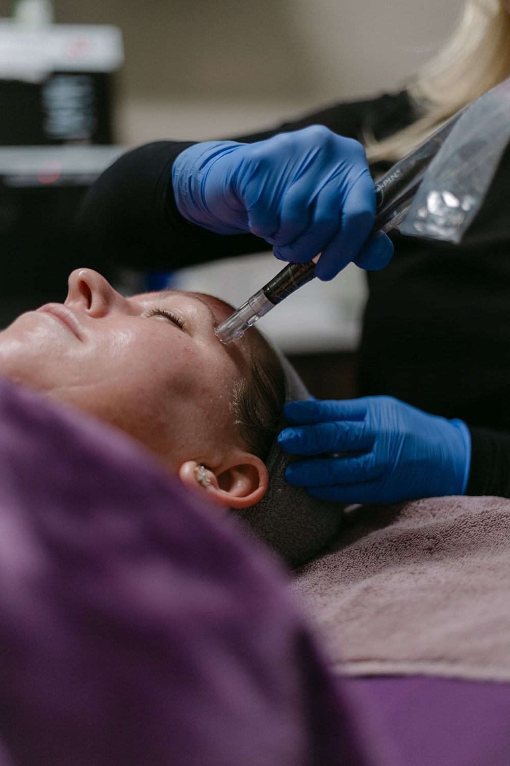 Microneedling treatment on a client's forehead.