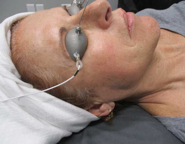 Sun Damage Before & After