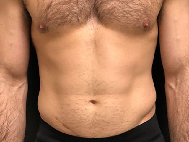 Cooltone Before & After