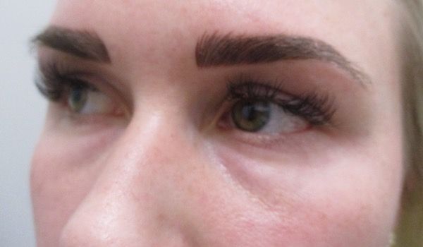 Under Eye Before & After