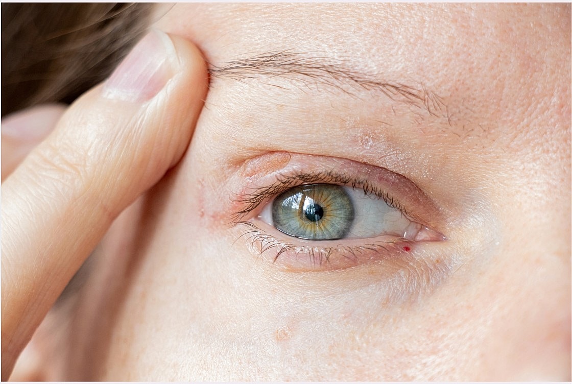 Close-up of an eye with a hand gently pressing.