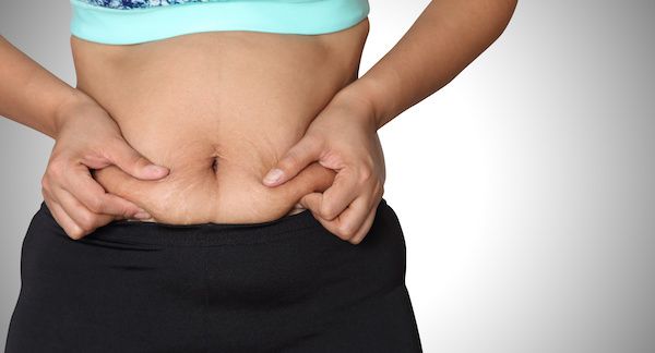 Getting A Tummy Tuck from a Patient's Perspective
