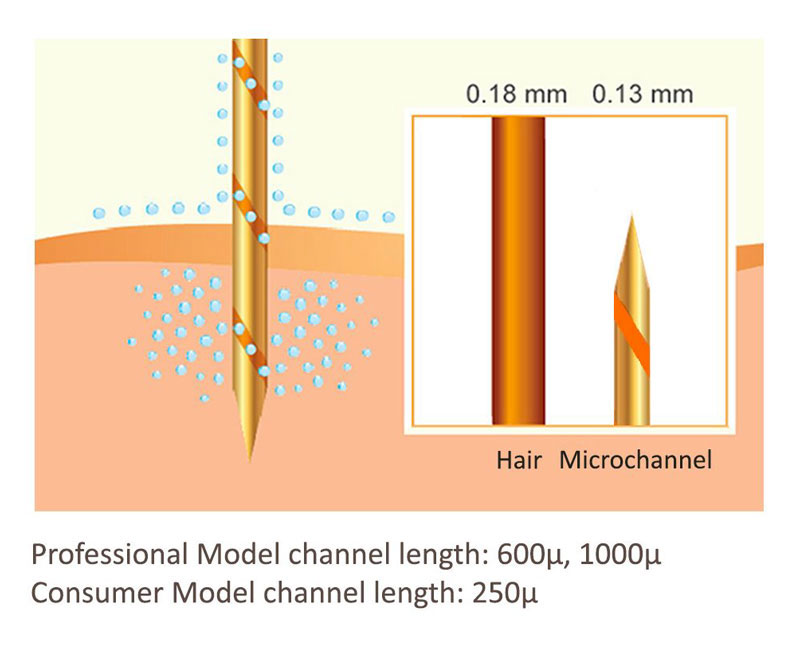 diagram of aquagold microchannel device for facial rejuvenation indianapolis